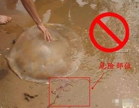 今年因为气温影响,较早进入海蜇蜇伤高峰期,预计高峰会持续到8月末.