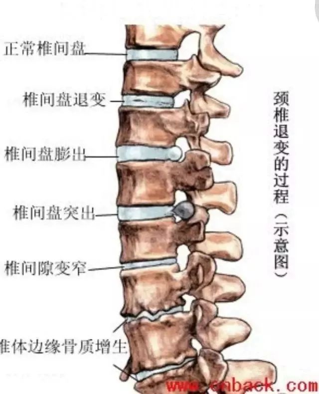 颈椎的钩椎关节位置图图片