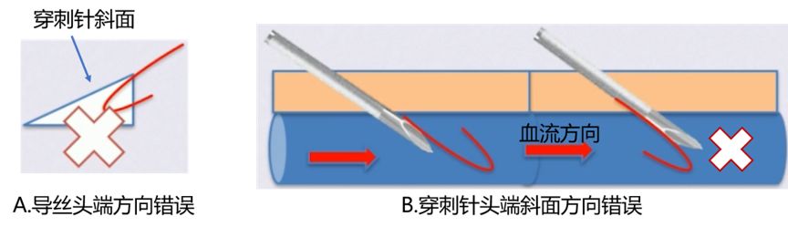 针头斜面向上的图片图片