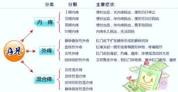 痔疮可以自愈吗有哪些治疗手段医生告诉你答案