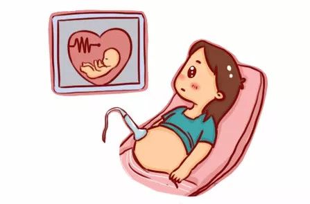 胎儿心脏彩超卡通图片