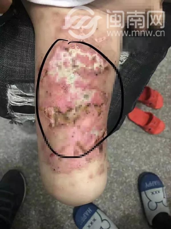 震惊福建5岁男童疑被后妈活活打死