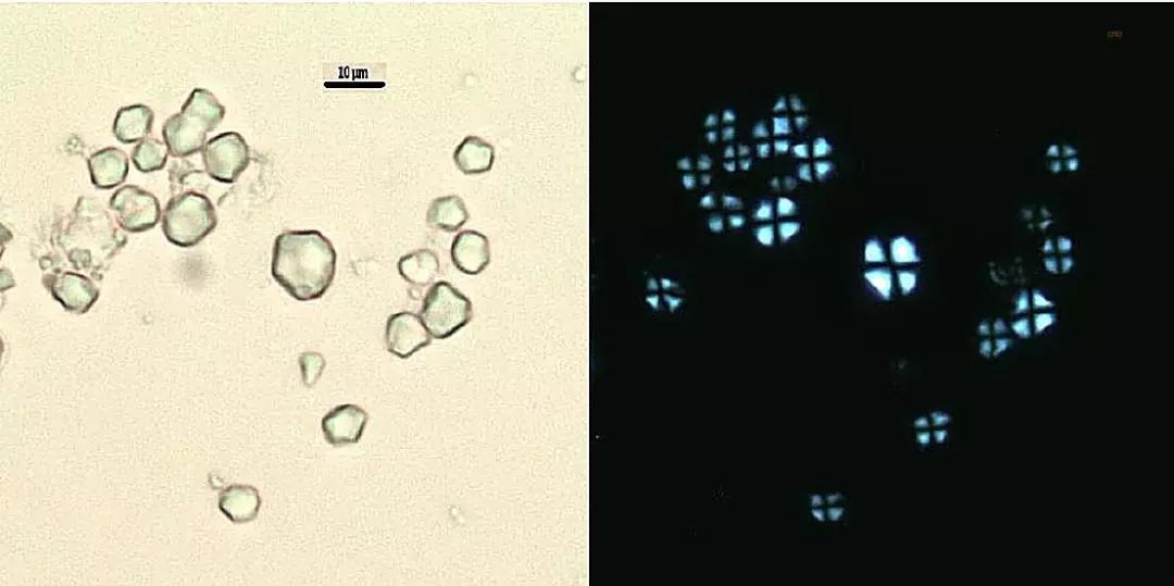 淀粉粒的三种类型图片