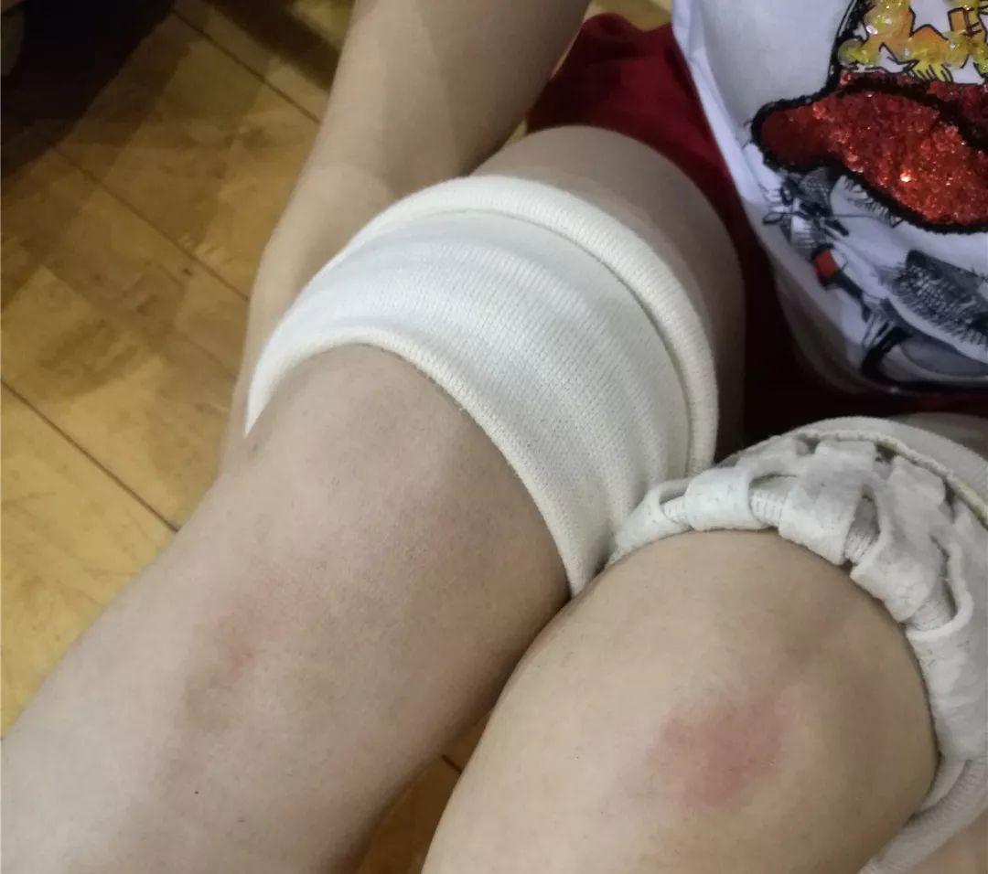 肿起乒乓球大小的筋包,她们在护膝里放进去海绵,臀部后面垫上毛巾等
