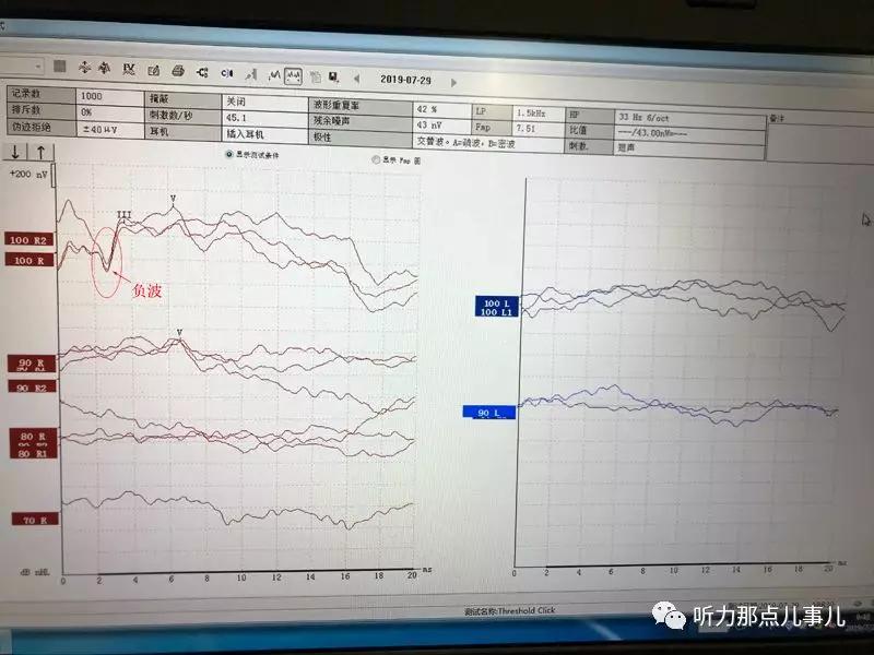 科普新生儿听力筛查温州助听器