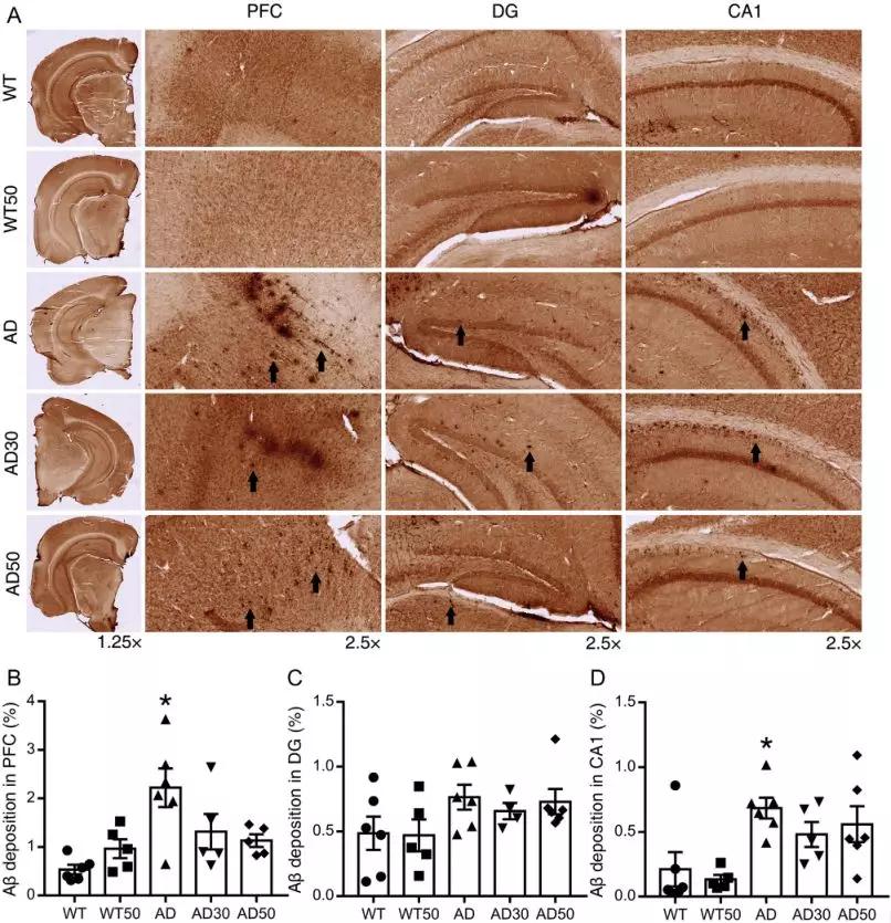 图:前额皮层和海马区的a β沉积.