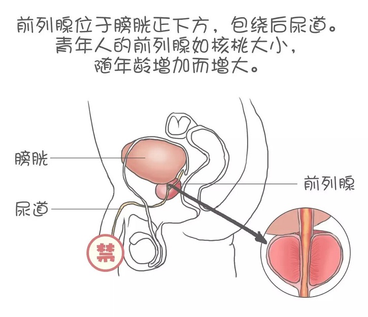 怎样找到自己的前列腺图片