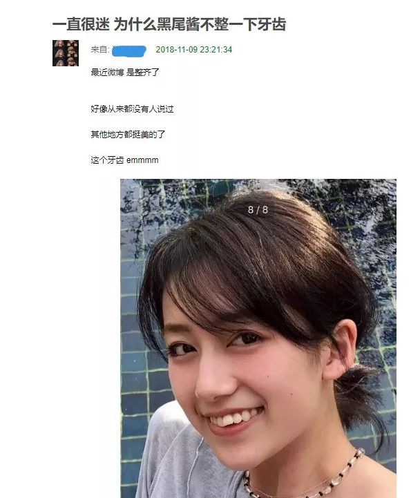 李诞老婆黑尾酱真实经历:矫正前功尽弃?一定不要忘了它!