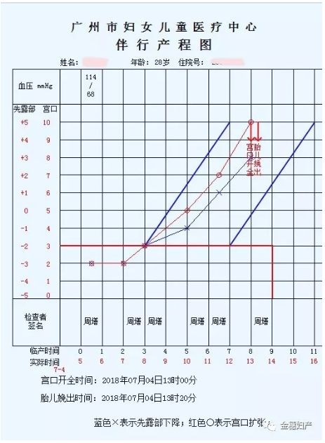 国内使用的产程伴行图关于产程图(partogram)或产程曲线(labor curve)