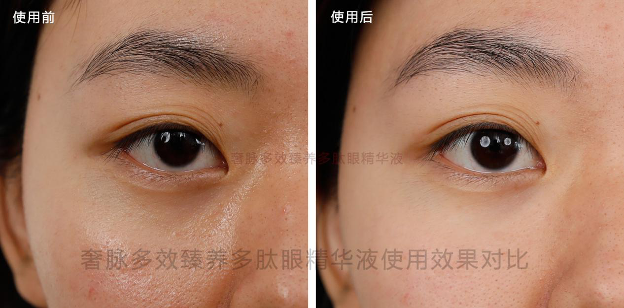 护肤测评,奢脉多效臻养多肽眼精华液怎么用?测评者使用效果对比