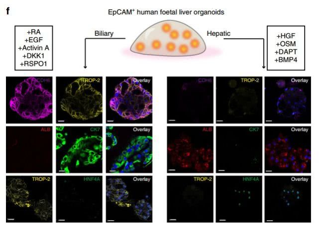医学前沿具有再生能力的肝胆混合祖细胞被发现有望替代肝移植