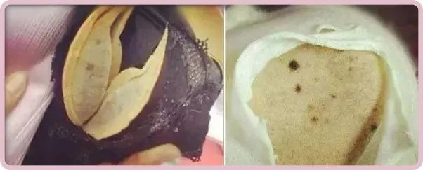 80妇科病由内裤引起你还在这样洗内衣裤吗