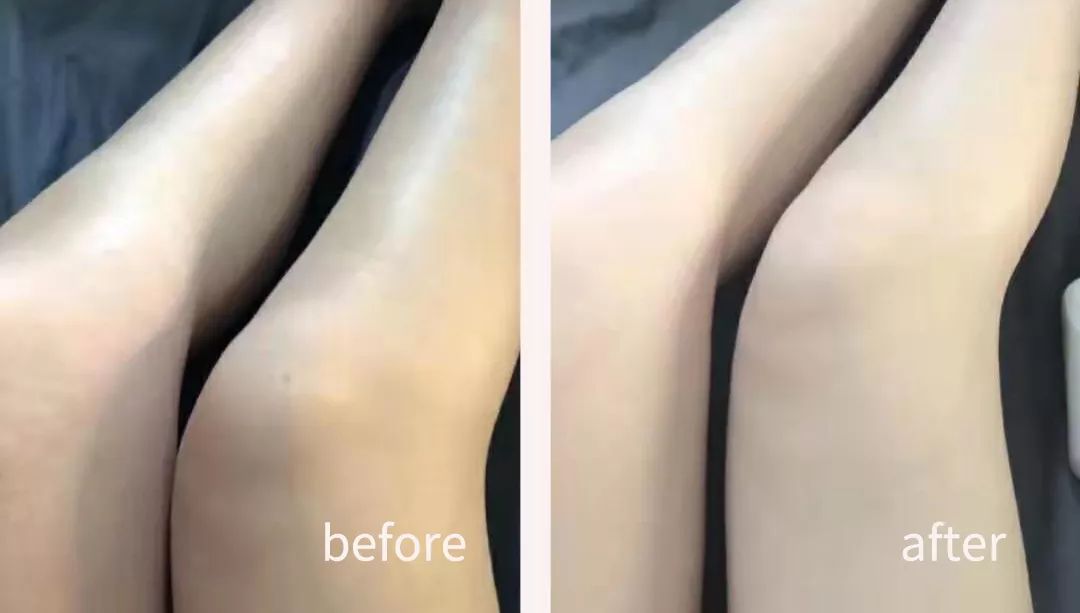 hanpeique噼里啪啦紧实精华霜局部减肉 紧致提拉减少橘皮纹 滋润皮肤