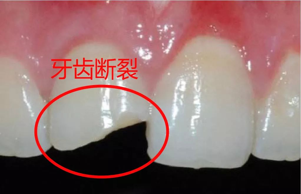 限购秒杀紫丁香口腔亲子主题店开业钜惠99元颗告别牙齿缺陷