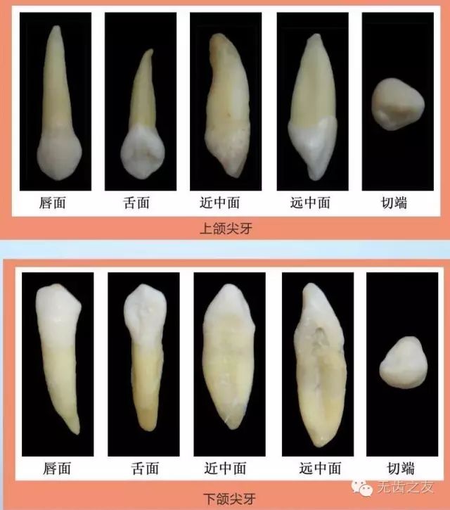 各个牙齿的牙体形态图图片