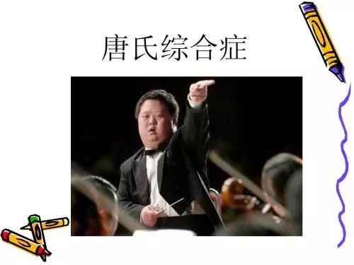 揭密唐氏综合症患者为何少患肿瘤