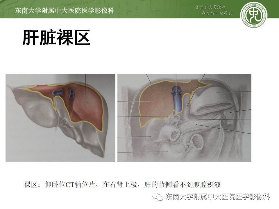 腹膜腔的解剖与分区