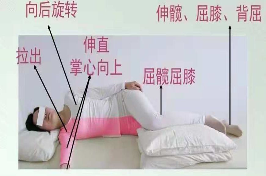 健侧卧位,患侧卧位,患侧卧位(第11页)_大山谷图库