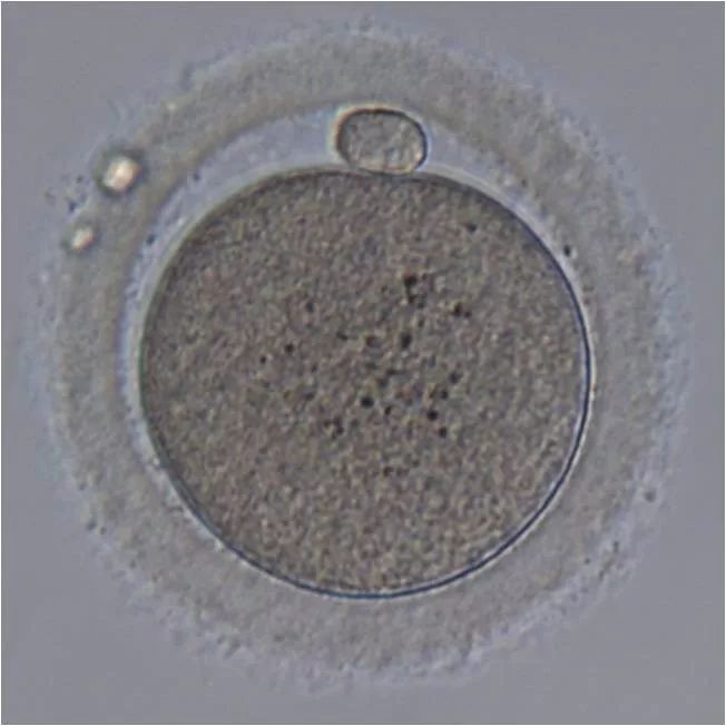 图1 mii成熟卵子图2 精子体外受精的方式包括常规体外受精(ivf)和卵母