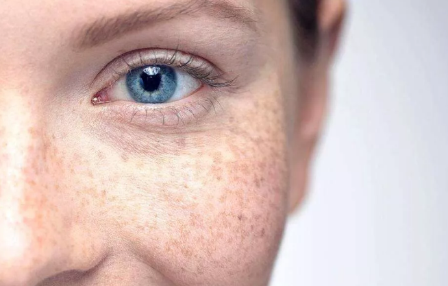 sismus蓝光喷雾 拯救刷屏时代女性光老化_皮肤