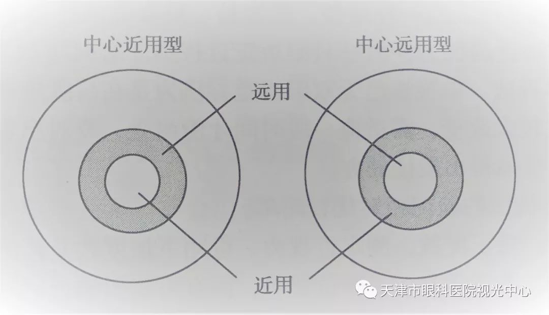 天津市眼科醫院視光中心張姝賢主任:多焦點軟性接觸鏡矯正老視的驗配