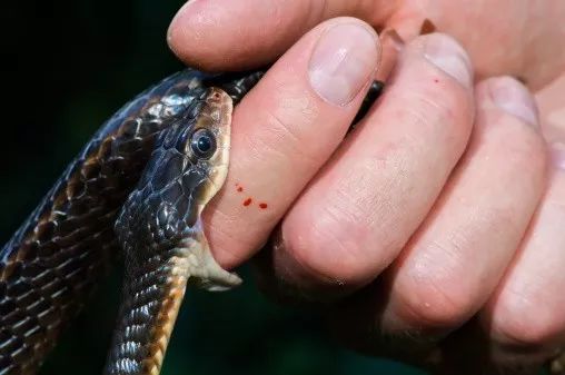 有人泡了三个月还被咬伤._蛇毒