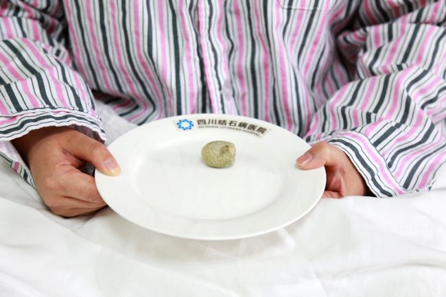 这几种人都是肾结石的高发人群大家不要中招了