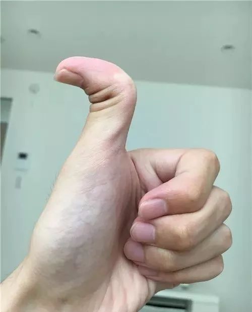 向后弯曲的大拇指▼展示了各种手指的花式动作:首先迎面走来的是肢体