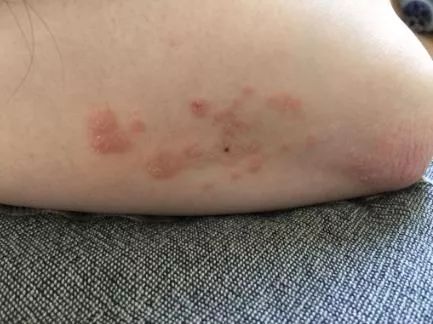 新衣服上竟有甲醛!不洗就穿会致癌?后悔知道晚了.