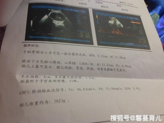 40歲孕婦懷孕43周仍未分娩,b超檢查以後,醫生怒斥孕媽不負責任