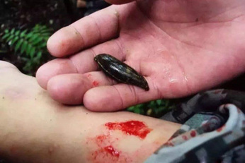 农忙时节要下田一只蚂蟥腿上爬童年大仇如何得报