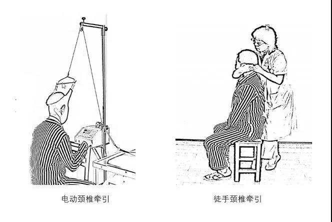 上吊式锻炼方式到底是护颈椎还是伤颈椎