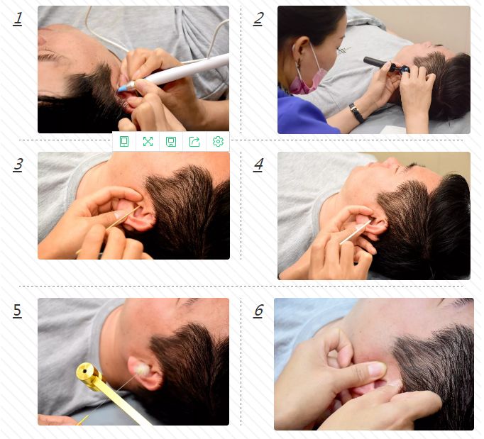 新郑采耳那家强渔夫子路上的杨波采耳1折遭疯抢以前不知道原来耳朵里