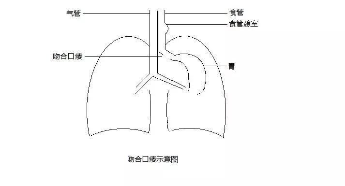 食道入口位置图图片