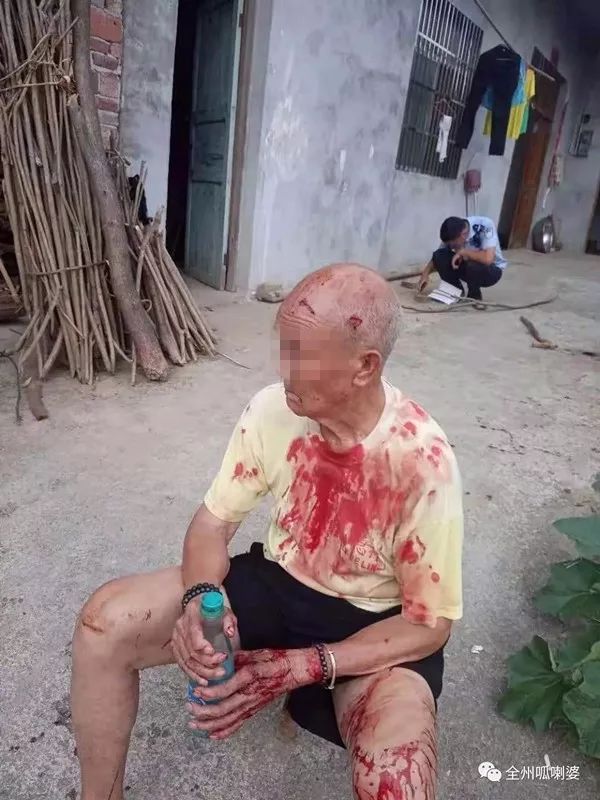 气愤丨桂林一老人被儿子打得头破血流,只是为了200块…_全州