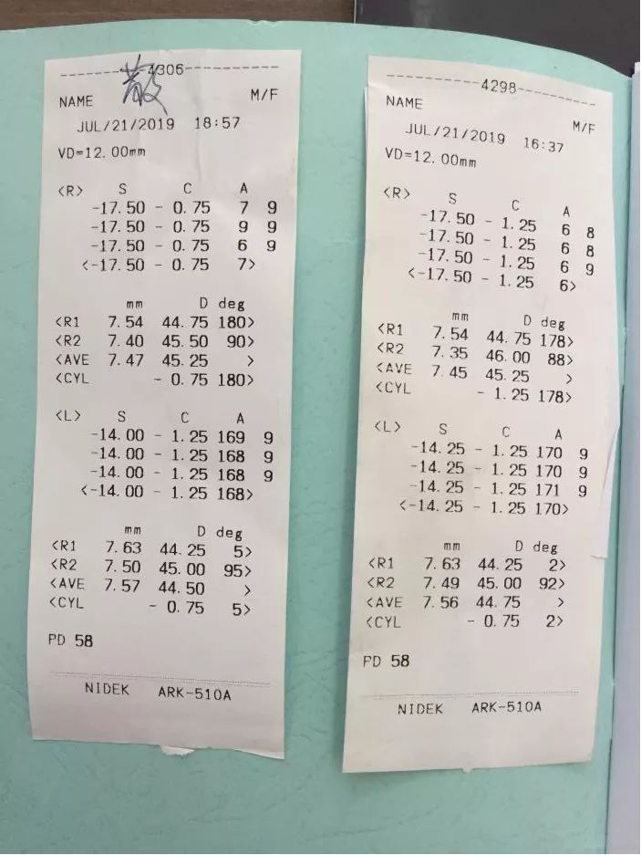 植入手術已經幫助許多高度近視患者成功摘鏡,重新獲得了清晰的視力