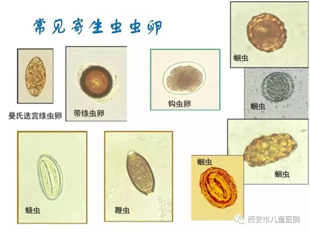 动物五大类,包括蛔虫,绦虫,蛲虫,钩虫,吸虫,线虫,弓形虫,原虫,疥虫