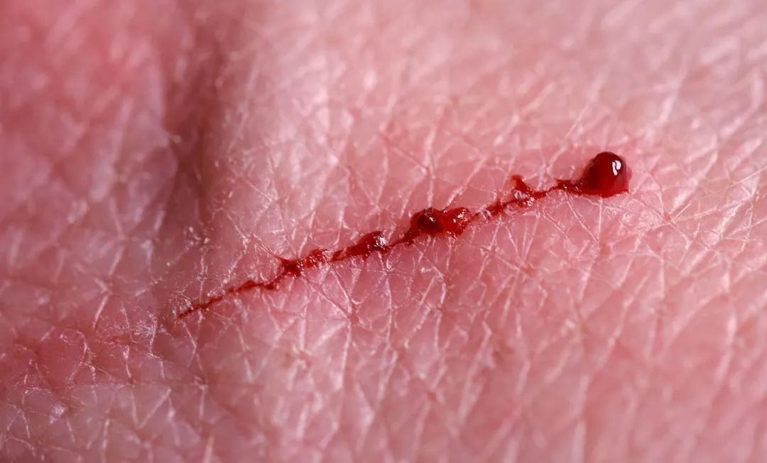 遍布全身的毛囊干细胞不仅可以拯救秃头还能促进皮肤伤口的修复