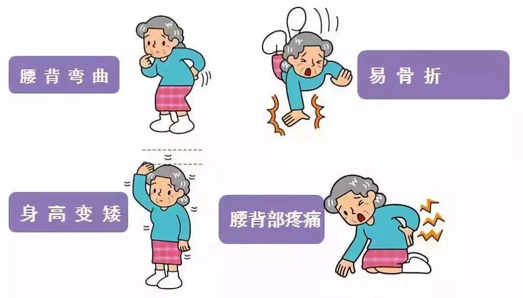 骨质疏松只发生在老年人身上大错特错