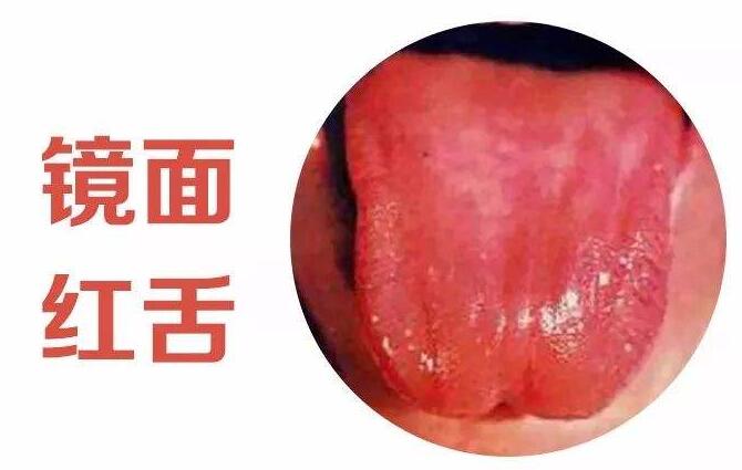孩子这些病都可从舌头判断出来,附解决办法,简单实用,快收藏