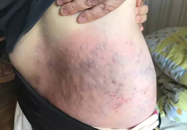 女性每天拍拍这条沟,不仅可以治疗妇科病,还可以变瘦!_腹股沟