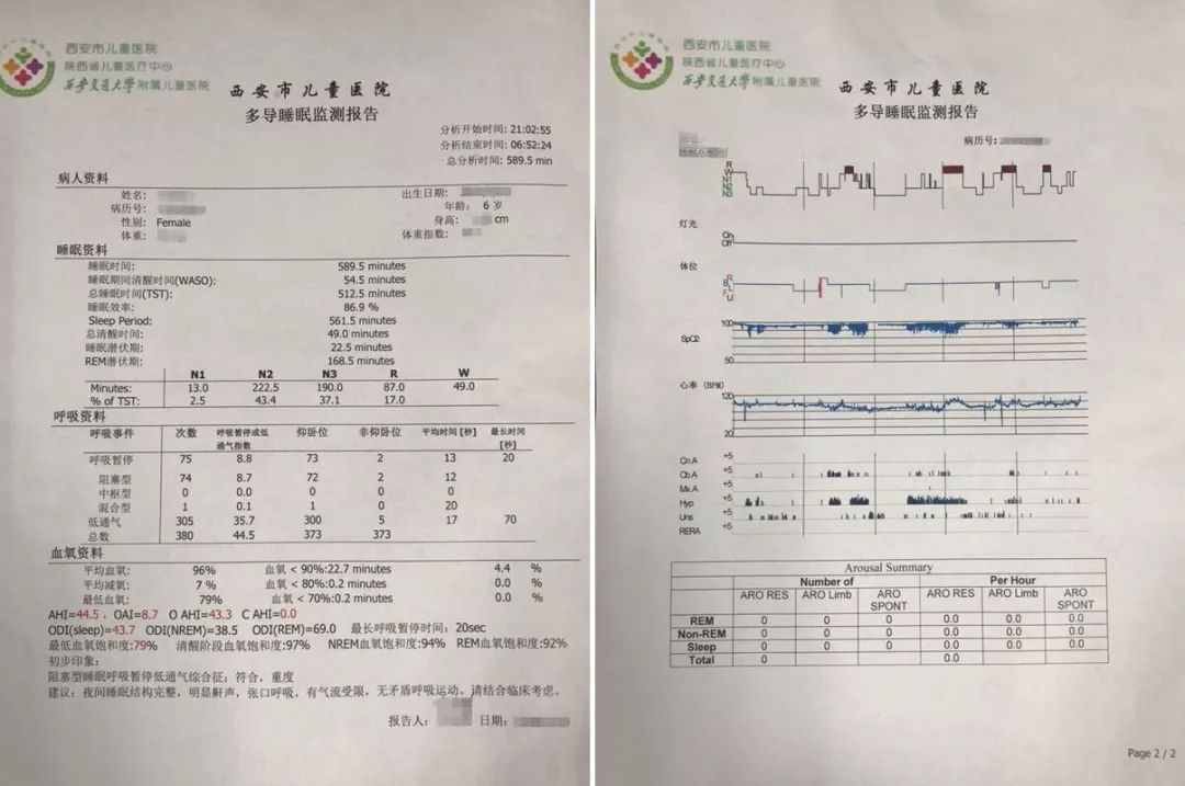 重庆呼吸机工程师告诉你,睡眠呼吸暂停患者如何选择呼吸机?