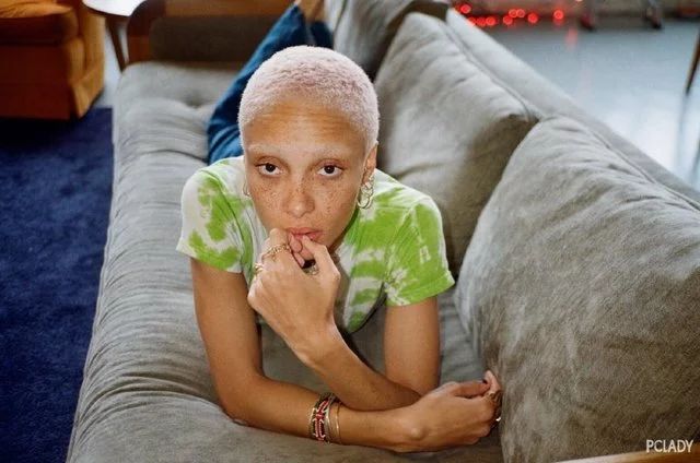 她满脸雀斑但却是时尚圈的宠儿还击败了其他各大超模