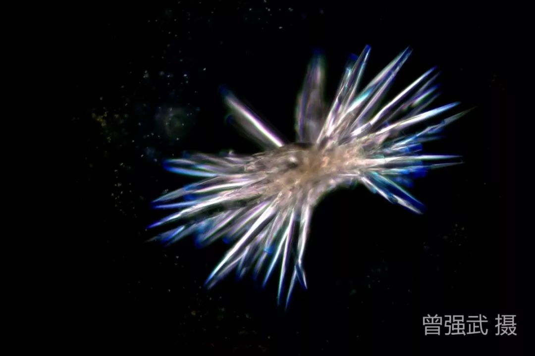 花瓣状结晶菱形/纺锤形结晶橄榄形结晶现给大家呈现尿酸结晶的常见