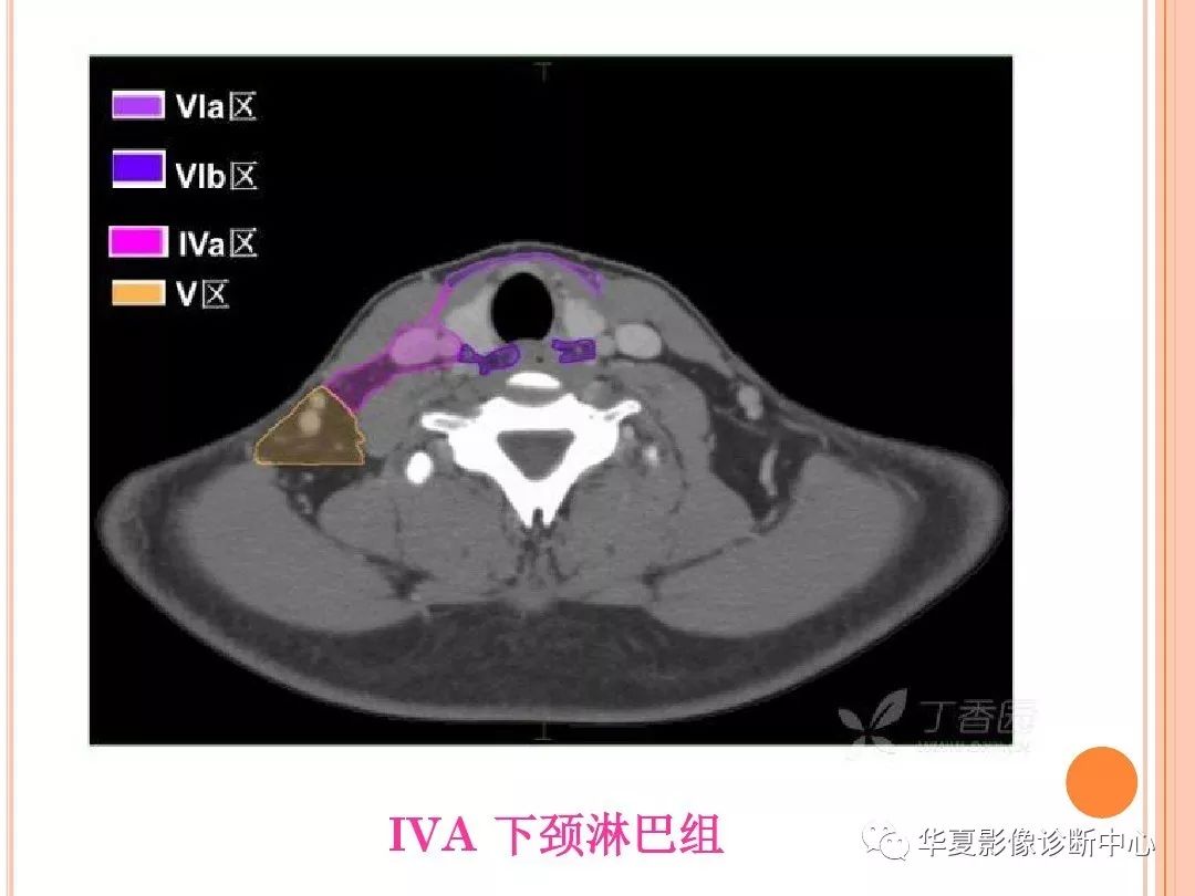 颈部淋巴结ct解剖图图片