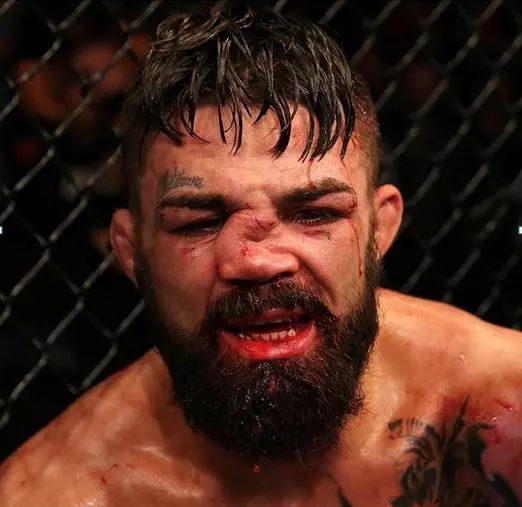 鼻梁骨极度扭曲仍战到最后!_佩里