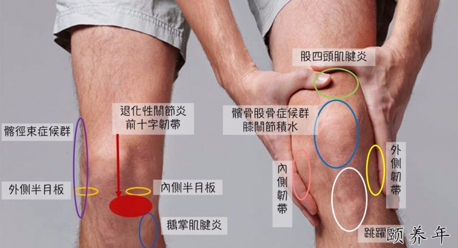 膝盖疼痛位置图图片