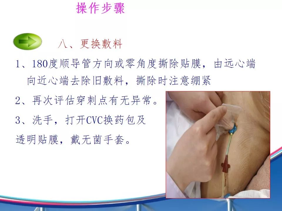 pptcvc中心静脉导管的维护