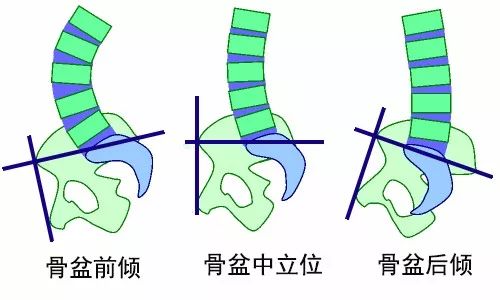 除了這種方法外,我們還可以通過髂前上棘和恥骨聯合組成的一個平面,與