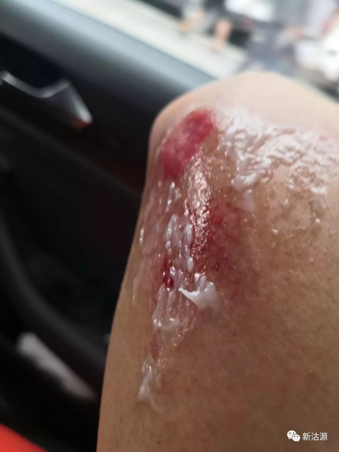 沽源人警惕这种害人精